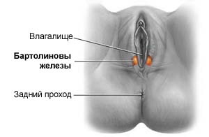 киста бартолиновой железы фото: киста бартолиновой железы
