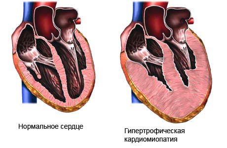 клиника лечение панических атак клиника лечение панических атак