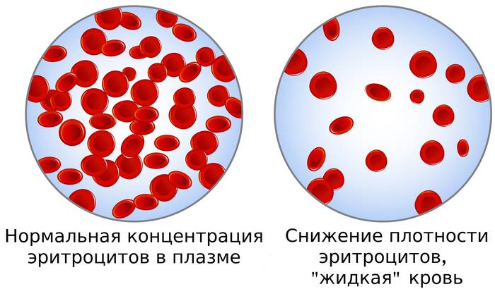 фото: эритроциты в плазме при сниженном гематокрите