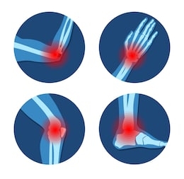 Суставы, страдающие при ревматизме