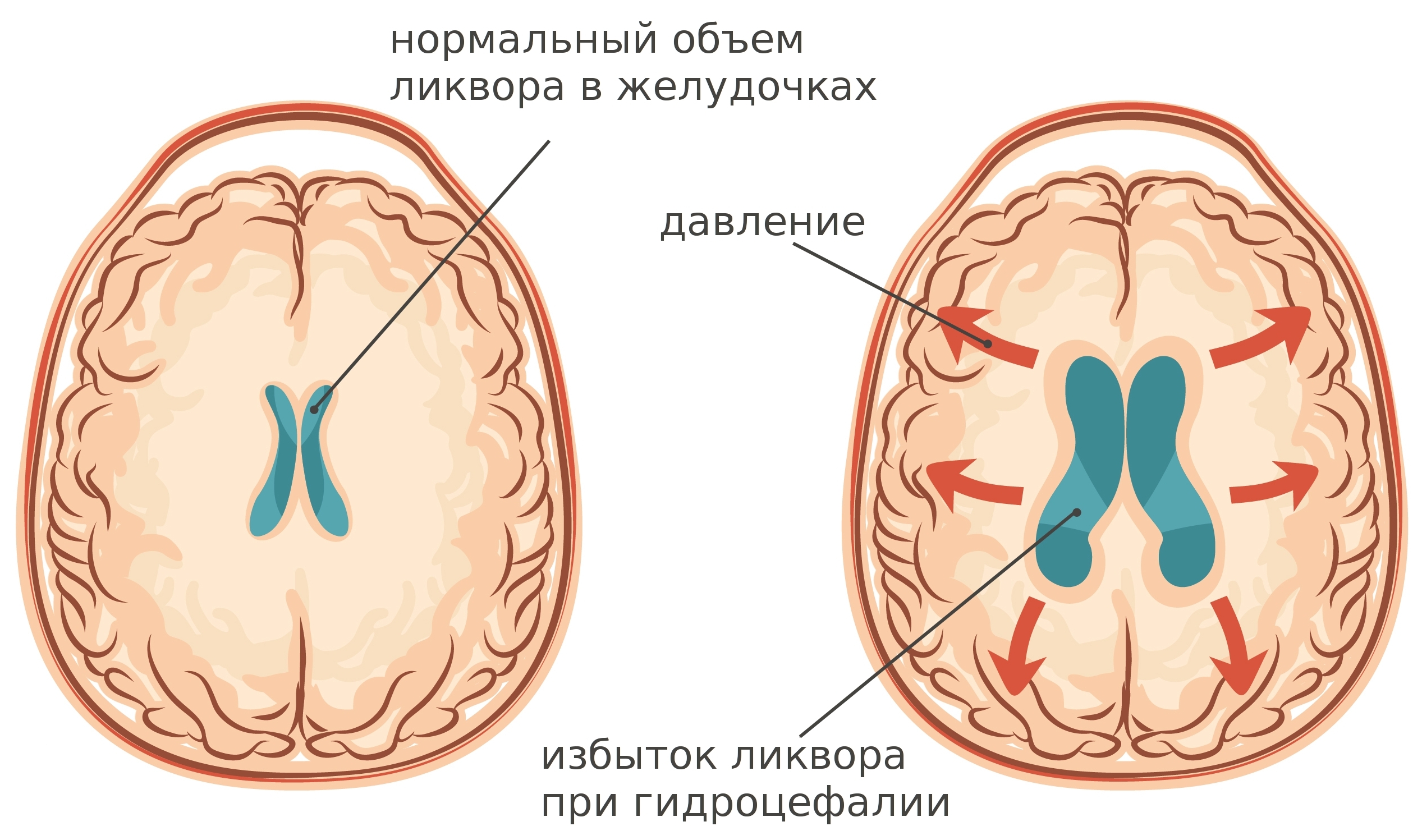 ггс фото